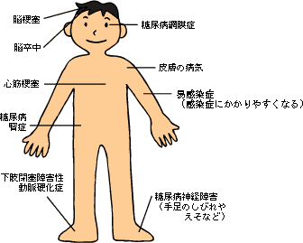 糖尿病の合併症